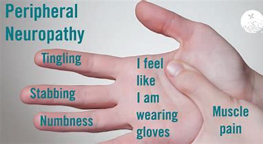 Image result for Neuropathy Symptoms
